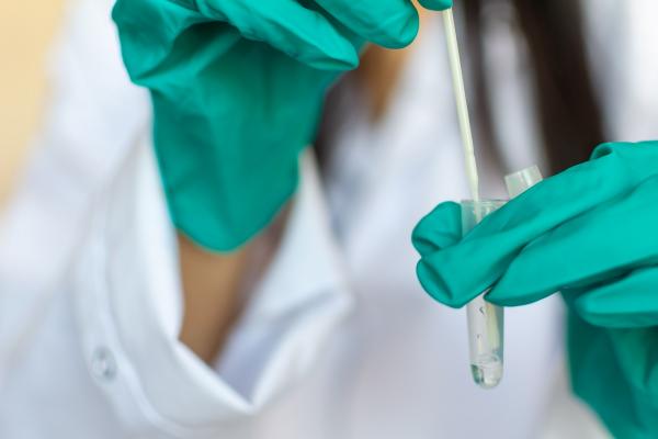 Bilanț coronavirus în România, 14 iulie. 79 de cazuri şi trei decese, în ultimele 24 de ore