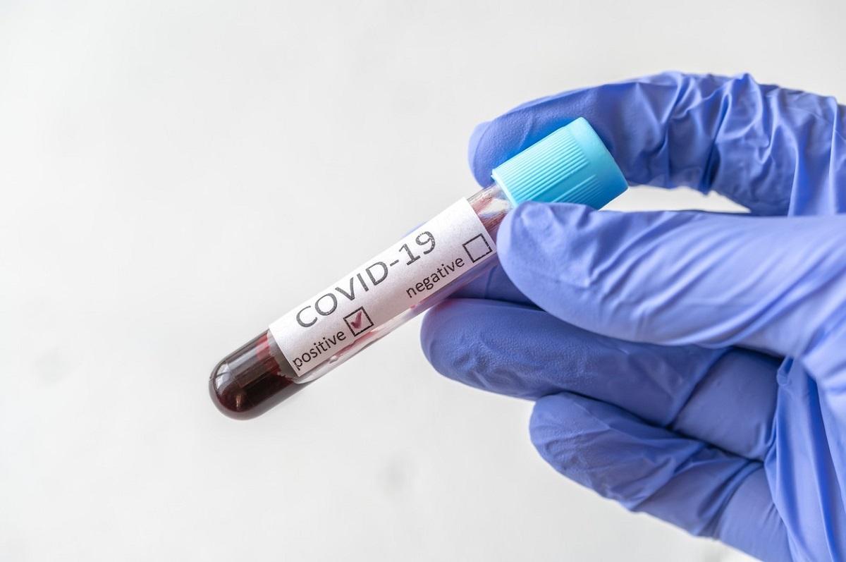 Experţii avertizează: "Varianta Beta a coronavirusului poate evita răspunsul imun generat de vaccinuri. A fost mereu o ameninţare pentru noi" Experţii avertizează: "Varianta Beta a coronavirusului poate evita răspunsul imun generat de vaccinuri. A fost mereu o ameninţare pentru noi"