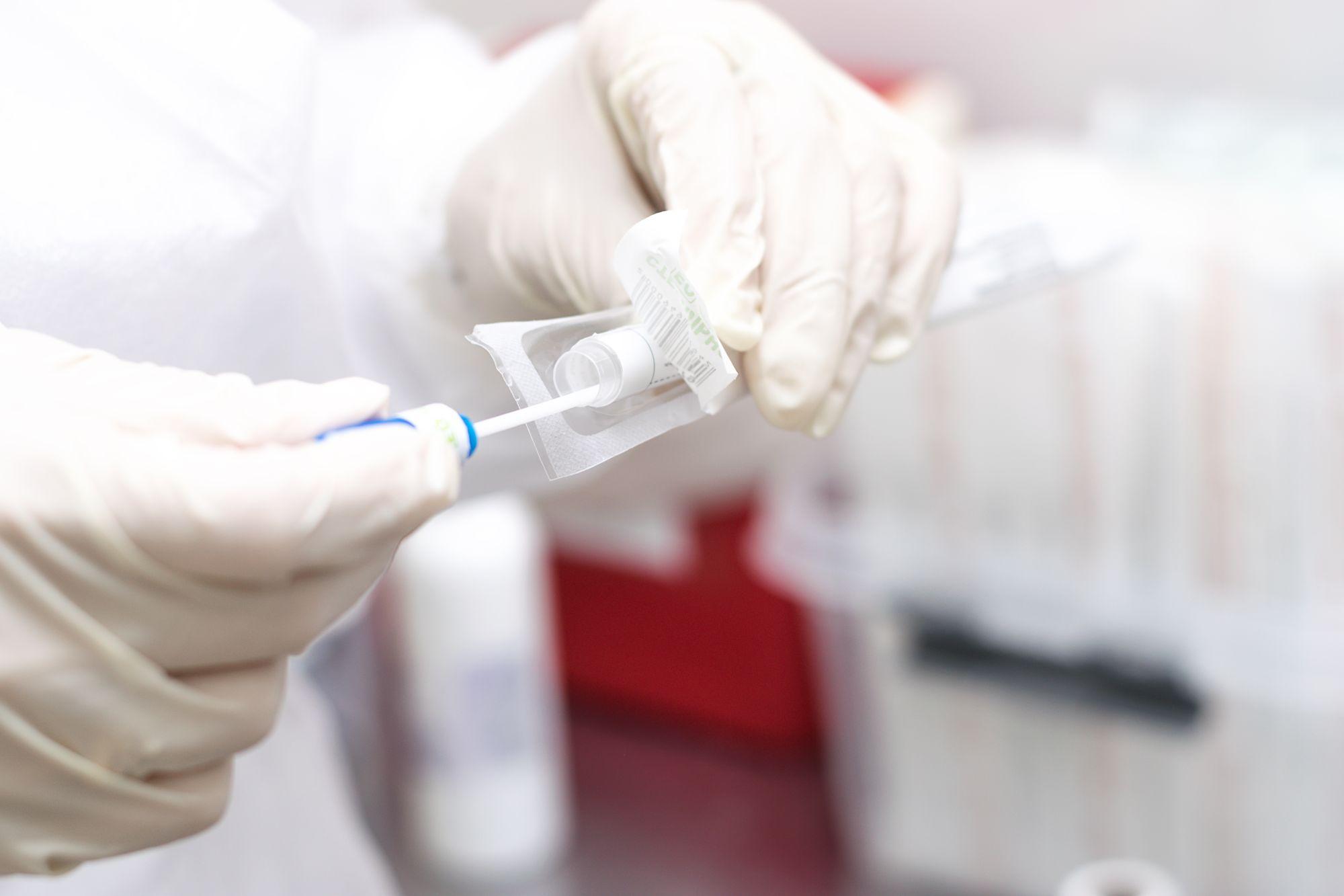 Bilanț coronavirus în România, 19 iulie. Test coronavirus