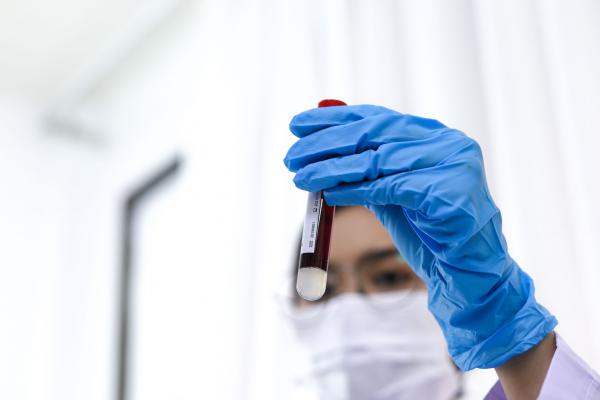 Bilanț coronavirus în România, 22 iulie.