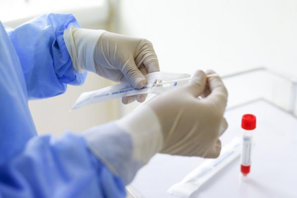 Bilanț coronavirus în România, 28 iulie.