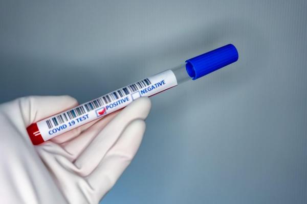 Test pentru depistarea coronavirus