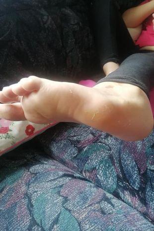 Serenity Harwood s-a născut cu o malformație la picioare care a făcut-o să-și dorească amputarea