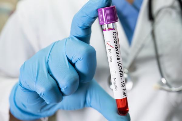 Bilanț coronavirus în România, 7 iulie. 60 de cazuri şi două decese, în ultimele 24 de ore