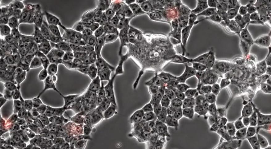Ce se întâmplă în creierul unui om bolnav de Covid. Imagini surprinse la microscop de doi cercetători francezi Ce se întâmplă în creierul unui om bolnav de Covid. Imagini surprinse la microscop de doi cercetători francezi