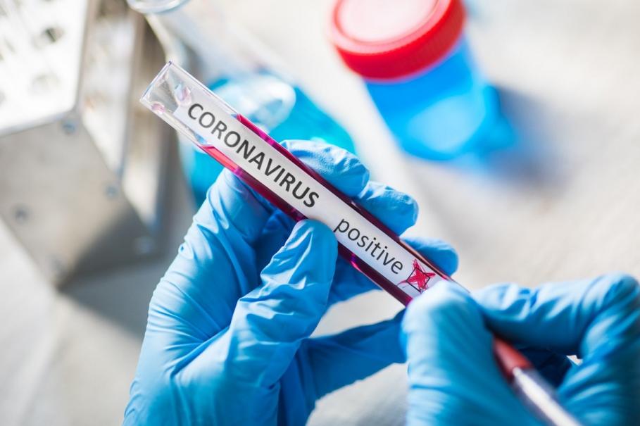 Test pentru depistarea coronavirus