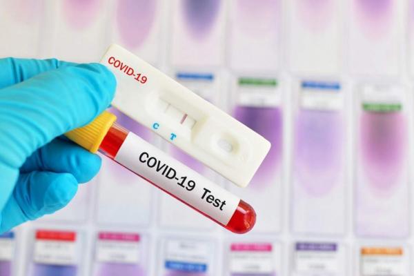 Bilanț coronavirus în România, 3 august 2021