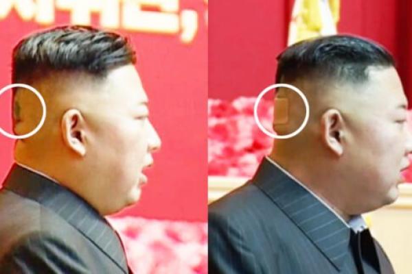 Bandajul apărut pe ceafa lui Kim Jong-un alimentează speculațiile privind problemele de sănătate ale liderului nord-coreean