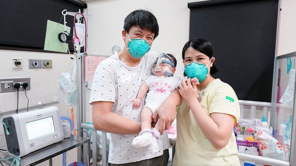 Cel mai mic bebeluş din lume, care cântărea la naştere cât un măr, a fost externat după 13 luni de spitalizare