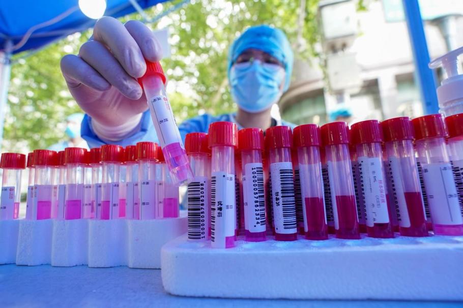 Peste 11 milioane de oameni, testaţi în cadrul unei campanii uriaşe în Wuhan. Dar copiii mai mici de 6 ani au fost scutiţi Peste 11 milioane de oameni, testaţi în cadrul unei campanii uriaşe în Wuhan. Dar copiii mai mici de 6 ani au fost scutiţi