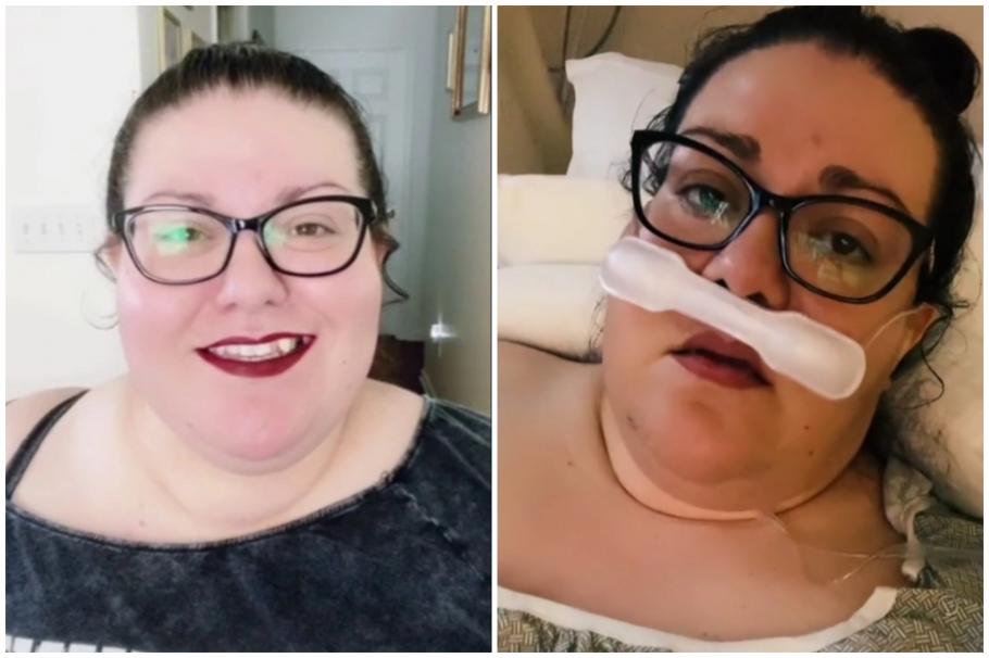 Alexandra Blankenbiller, înainte şi după infectarea cu SARS-CoV-2 Alexandra Blankenbiller, înainte şi după infectarea cu SARS-CoV-2