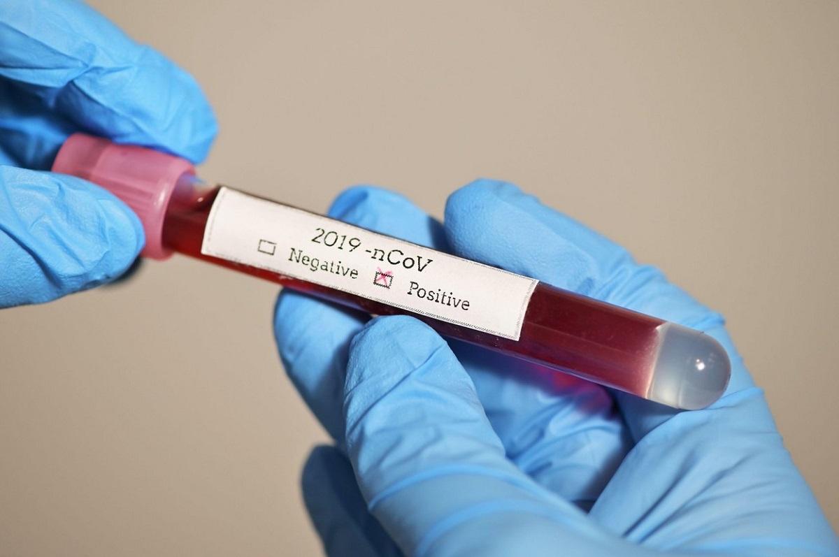 Test pentru depistarea coronavirus