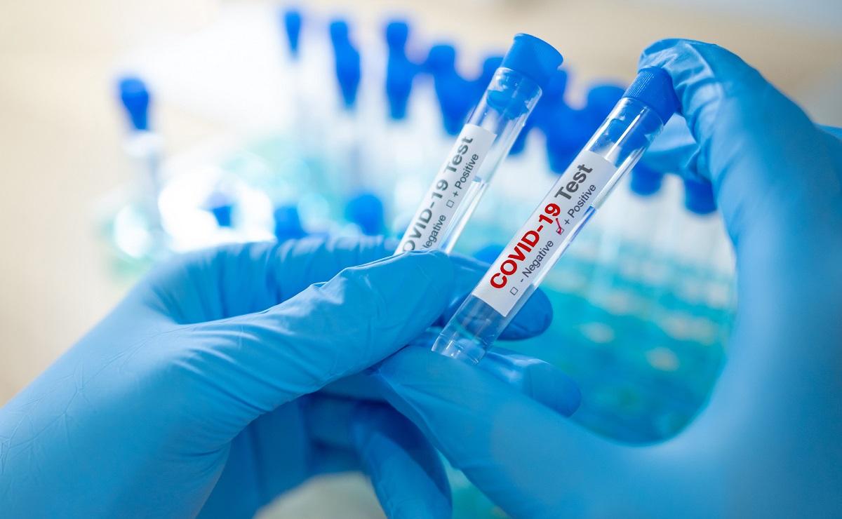 test covid Test pentru depistarea coronavirus