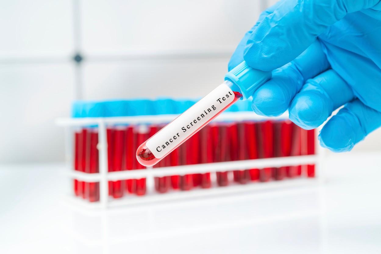 Marea Britanie lansează cel mai mare studiu din lume pentru un test de sânge care poate detecta peste 50 de tipuri de cancer Marea Britanie lansează cel mai mare studiu din lume pentru un test de sânge care poate detecta peste 50 de tipuri de cancer