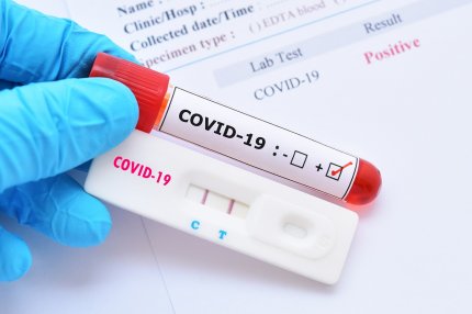 Test pentru depistarea coronavirus