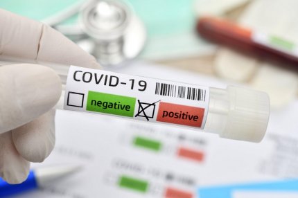 Test pentru depistarea coronavirus