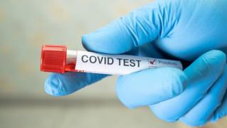 478 cazuri noi de persoane infectate cu coronavirus, în ultimele 24 de ore. 6 persoane au murit