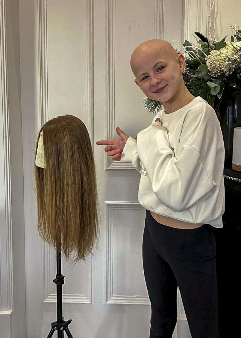 Colegii râdeau de ea pentru că este cheală