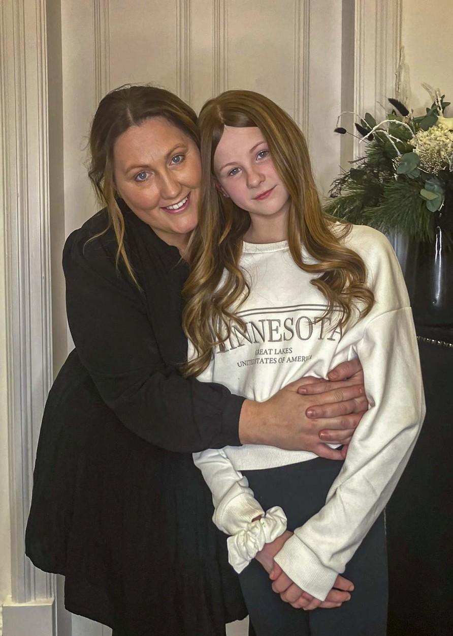 Colegii râdeau de ea pentru că este cheală