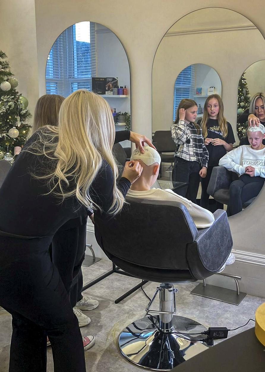 Colegii râdeau de ea pentru că este cheală