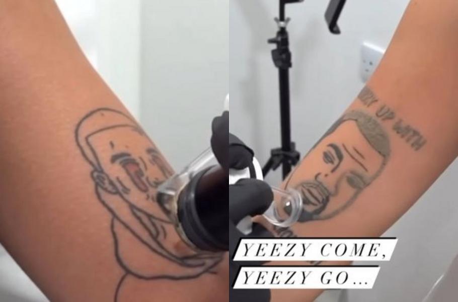 Un salon care se ocupă cu îndepărtarea tatuajelor își oferă serviciile gratuit pentru cei care au tatuaje cu Kanye West, în Londra Salonul a luat această inițiativă după ce cântărețul a făcut declarații extrem de jignitoare
