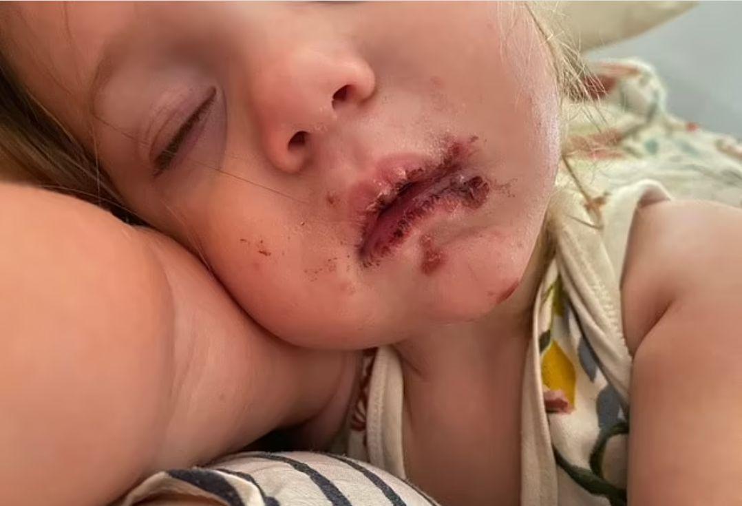 Coșmarul prin care a trecut o fetiță de doi ani după ce a fost pupată pe gură de un adult