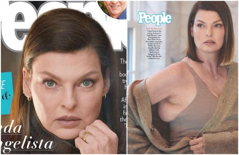 Linda Evangelista a împărtășit primele imagini cu trupul ei ''brutal desfigurat'' de o procedură cosmetică Linda Evangelista a împărtășit primele imagini cu trupul ei ''brutal desfigurat'' de o procedură cosmetică