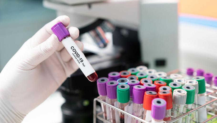 Bilanț coronavirus în România, 22 februarie. Bilanț coronavirus în România, 22 februarie.