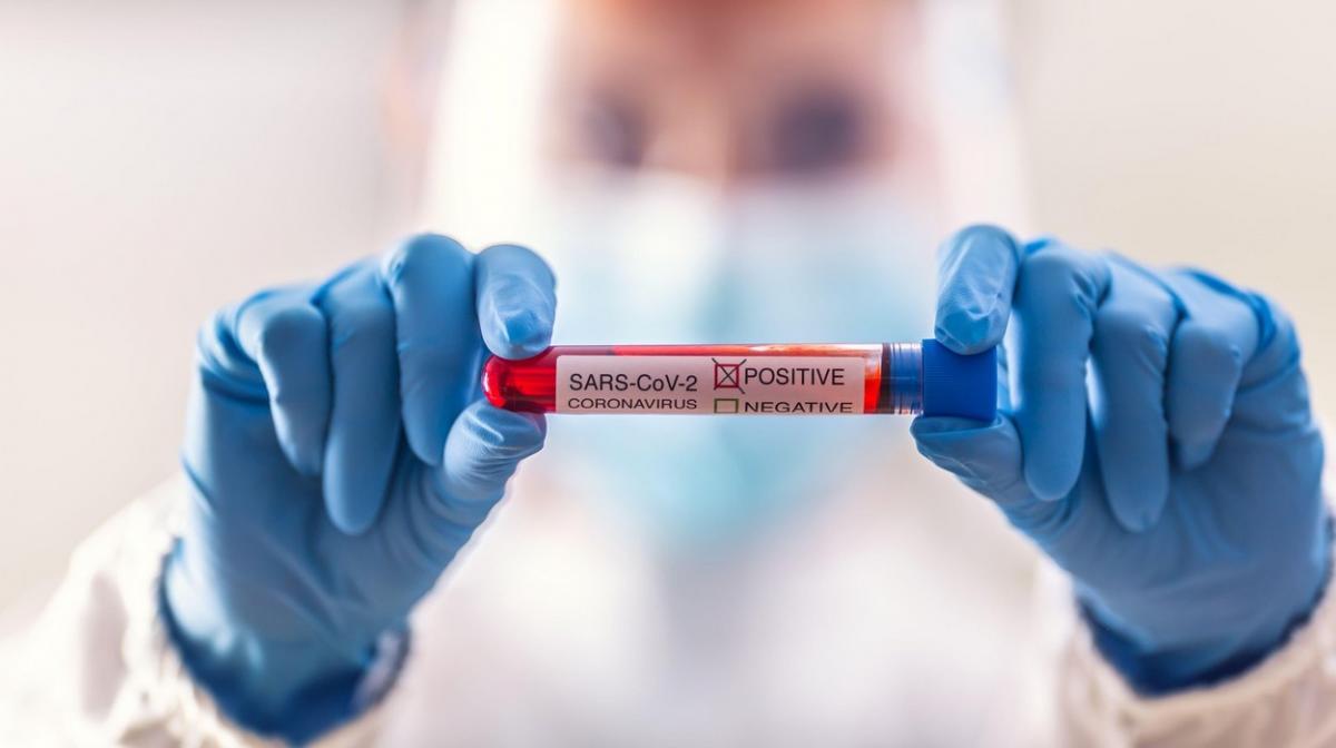 test covid Test pentru depistarea coronavirus
