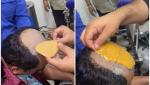 "Bagaj" preţios, ascuns sub perucă. Un bărbat a fost prins cu aur în valoare de 40.000 de dolari asupra sa, pe aeroportul din Delhi
