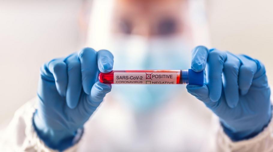 Bilanț coronavirus în România, 30 aprilie. Aproape 900 de cazuri noi în ultimele 24 de ore Bilanț coronavirus în România, 30 aprilie. Aproape 900 de cazuri noi în ultimele 24 de ore