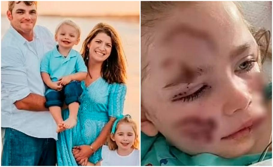 O fetiţă de 4 ani a rămas cu cicatrici îngrozitoare pe față, după ce a fost atacată împreună cu mama ei de câinele vecinului O fetiţă de 4 ani a rămas cu cicatrici îngrozitoare pe față, după ce a fost atacată împreună cu mama ei de câinele vecinului
