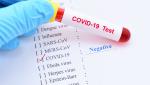 Bilanț coronavirus în România, 20 mai. Aproape 400 de cazuri noi şi 4 decese, în ultimele 24 de ore