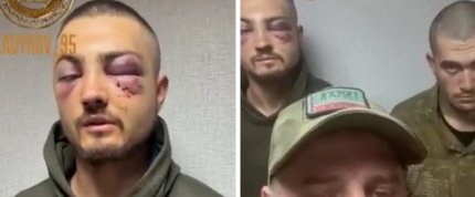 Cum explică cecenii faptul că unul dintre militarii ucraineni capturaţi are ochii vineţi: "A călcat pe o greblă. Cred că preferă vânătăi decât gloanţe"