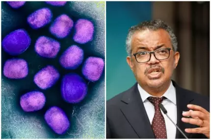 Şeful OMS cere să se evite stigmatizarea şi discriminarea în cazul pacienţilor cu variola maimuţei: "Pot fi la fel de periculoase ca orice virus" Şeful OMS cere să se evite stigmatizarea şi discriminarea în cazul pacienţilor cu variola maimuţei: "Pot fi la fel de periculoase ca orice virus"