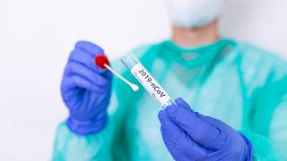 Bilanț coronavirus în România, 17 august. 7.500 de cazuri noi, în ultimele 24 de ore. Rata de infectare în Capitală, la 7,08