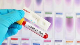 Bilanț coronavirus în România, 18 august. Peste 5.000 de cazuri noi și 24 de decese, în ultimele 24 de ore
