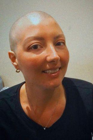 Femeia a fost diagnosticată cu o formă foarte rară de cancer la sân