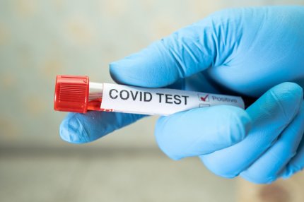 Test pentru depistarea coronavirus