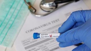 Bilanț coronavirus în România, 23 august. Peste 5.600 de cazuri noi și 47 de decese, în ultimele 24 de ore