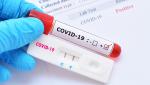 Bilanț coronavirus în România, 6 august. 28 de decese şi peste 6.000 de cazuri noi, în ultimele 24 de ore