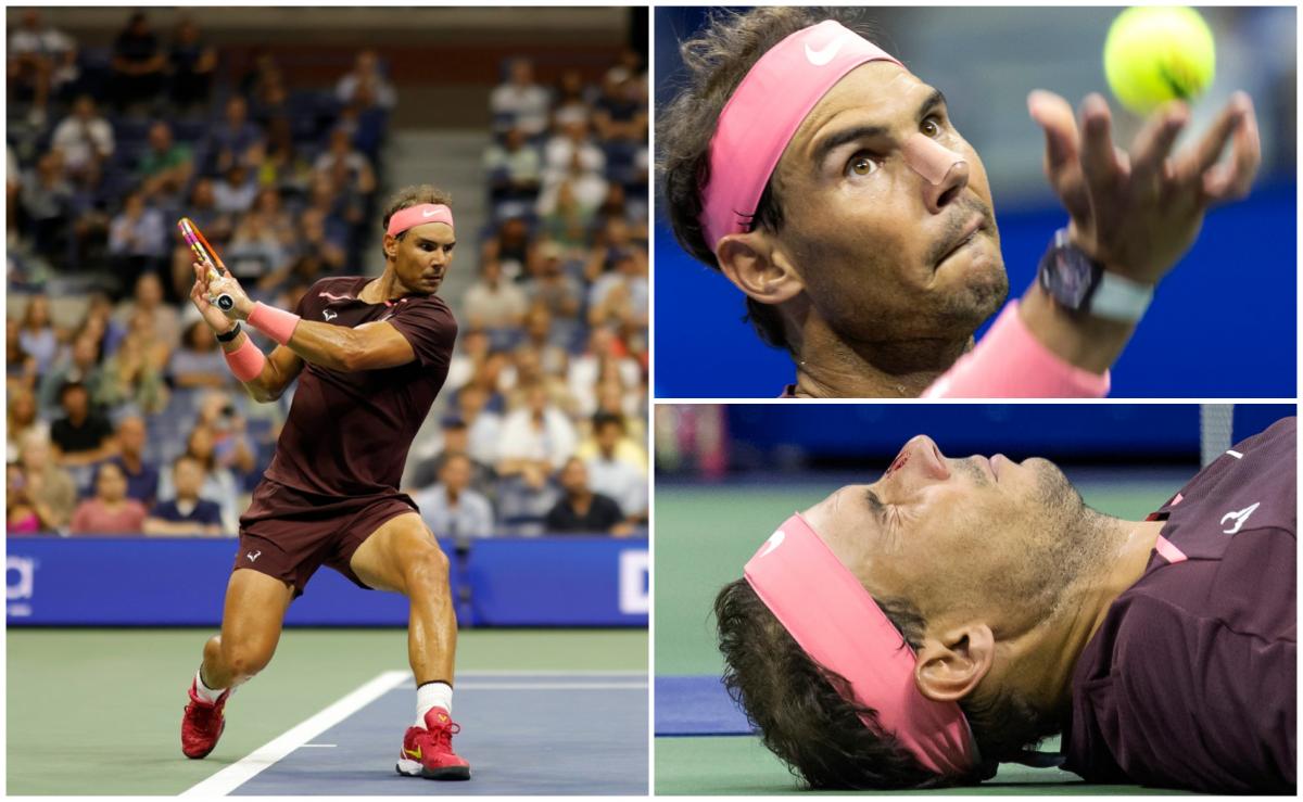 Rafael Nadal s-a lovit peste faţă cu propria rachetă la US Open Rafael Nadal s-a lovit peste faţă cu propria rachetă la US Open