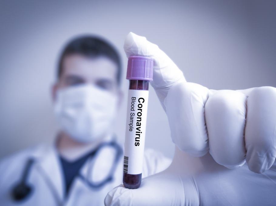 Bilanț coronavirus în România, 6 septembrie. 2.876 de cazuri noi de COVID-19, înregistrate în ultimele 24 de ore, cu 1.700 mai multe faţă de ziua anterioară Bilanț coronavirus în România, 6 septembrie. 2.876 de cazuri noi de COVID-19, înregistrate în ultimele 24 de ore, cu 1.700 mai multe faţă de ziua anterioară