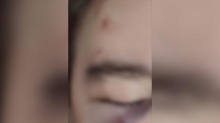 Un elev din Craiova a fost bătut de un coleg de clasă în pauza dintre cursuri. Agresorul are 15 ani