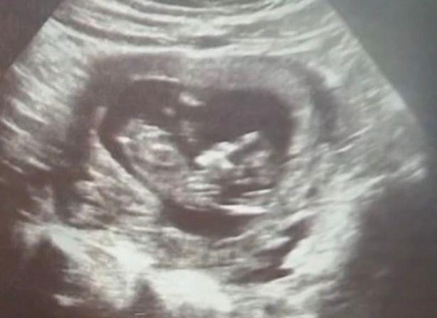 Împușcată în cap în timp ce-și aștepta tatăl să cumpere o prăjitură, în SUA. Marissa urma să devină mamă