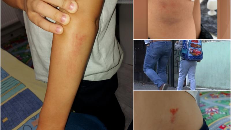 Caz uluitor la o şcoală din Braşov. Un elev de 7 ani îşi bate toţi colegii, iar aceştia nu mai au curaj să vină la ore