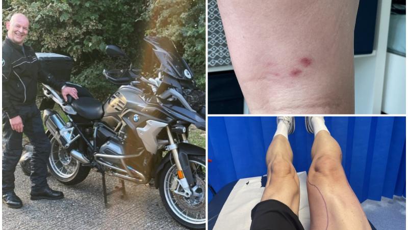 "Mi s-a spus că ar fi trebuit să mor în 48 de ore". Un tată, la un pas să moară după ce a fost mușcat de un șarpe veninos, care a mers pe motocicleta sa prin Europa