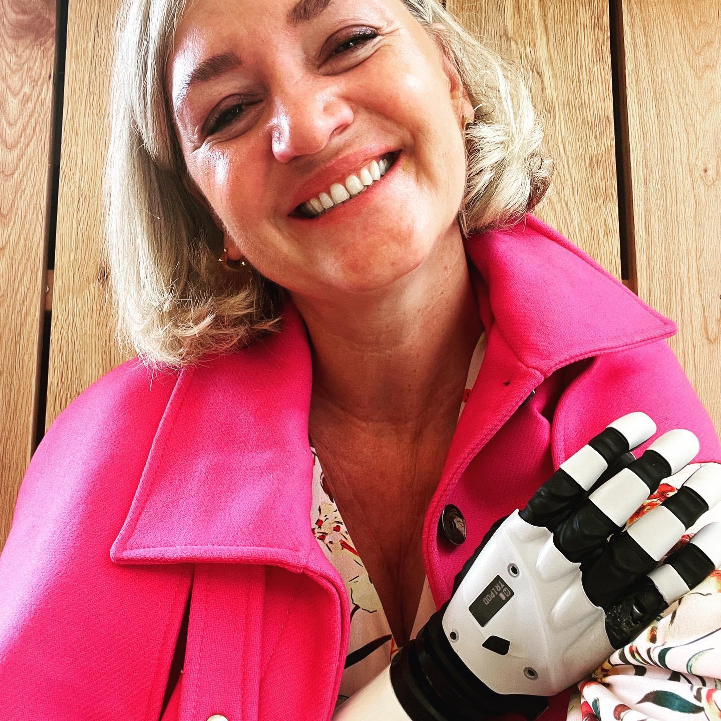 Și-a pierdut mâna și piciorul, după ce a fost lovită de două trenuri, în stația de metrou din UK