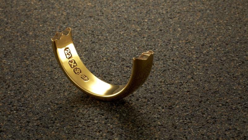 Intervenţie neobişnuită pentru pompierii din Botoşani. Au fost chemaţi la spital pentru a tăia cu flexul verigheta unui pacient