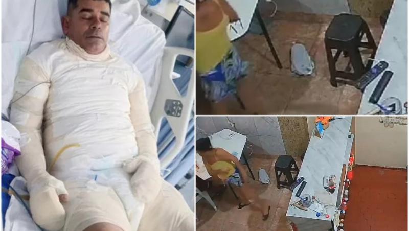 Orbită de gelozie, o femeie și-a stropit soțul cu alcool și i-a dat foc. Bărbatul din Brazilia a murit la spital